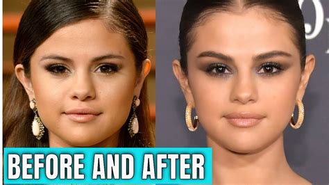 selena gomez boobs before and after|Selena Gomez before and after plastic surgery: boobs。